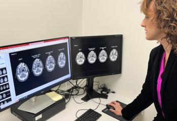  Dr. Amanda Cherpak in front of the ETHOS radiotherapy cancer care system at the QEII Health Sciences Centre's Dickson Building in Halifax, N.S. (Creeson Agecoutay/CTV National News)Previous Next Dr. Amanda Cherpak in front of the ETHOS radiotherapy cancer care system at the QEII Health Sciences Centre's Dickson Building in Halifax, N.S. (Creeson Agecoutay/CTV National News)  Dr. Amanda Cherpak looks at a comparison of hard to read images from older scanning devices and clearer pictures from the ETHOS